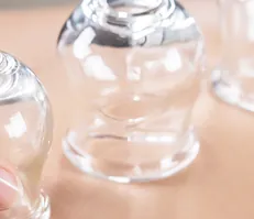 Cuppingtherapie